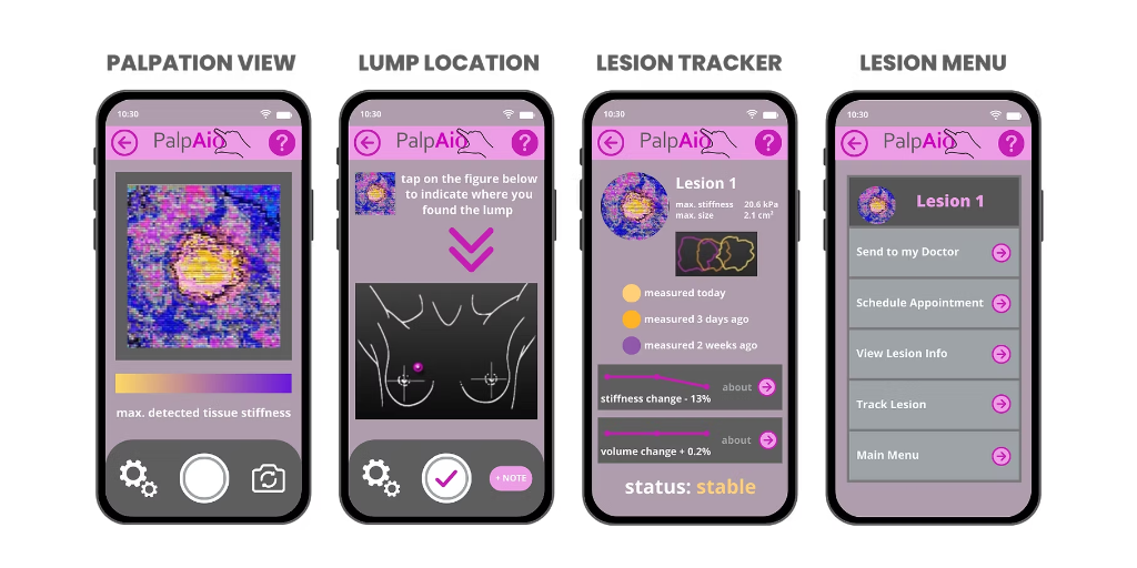 PalpAid App — Palpation View, Lump Location, Lesion Tracker, and Lesion Menu screens